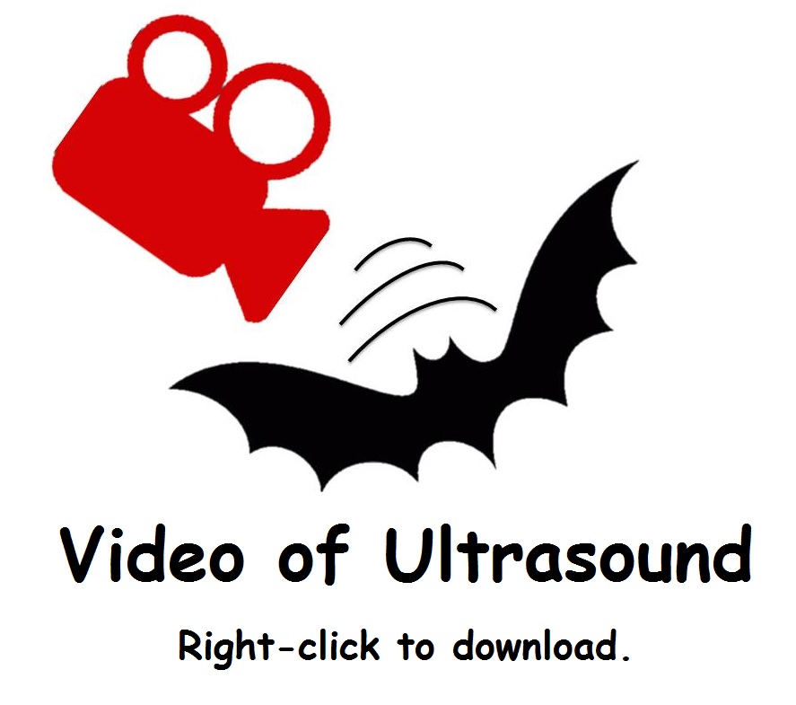 Ultrasound video