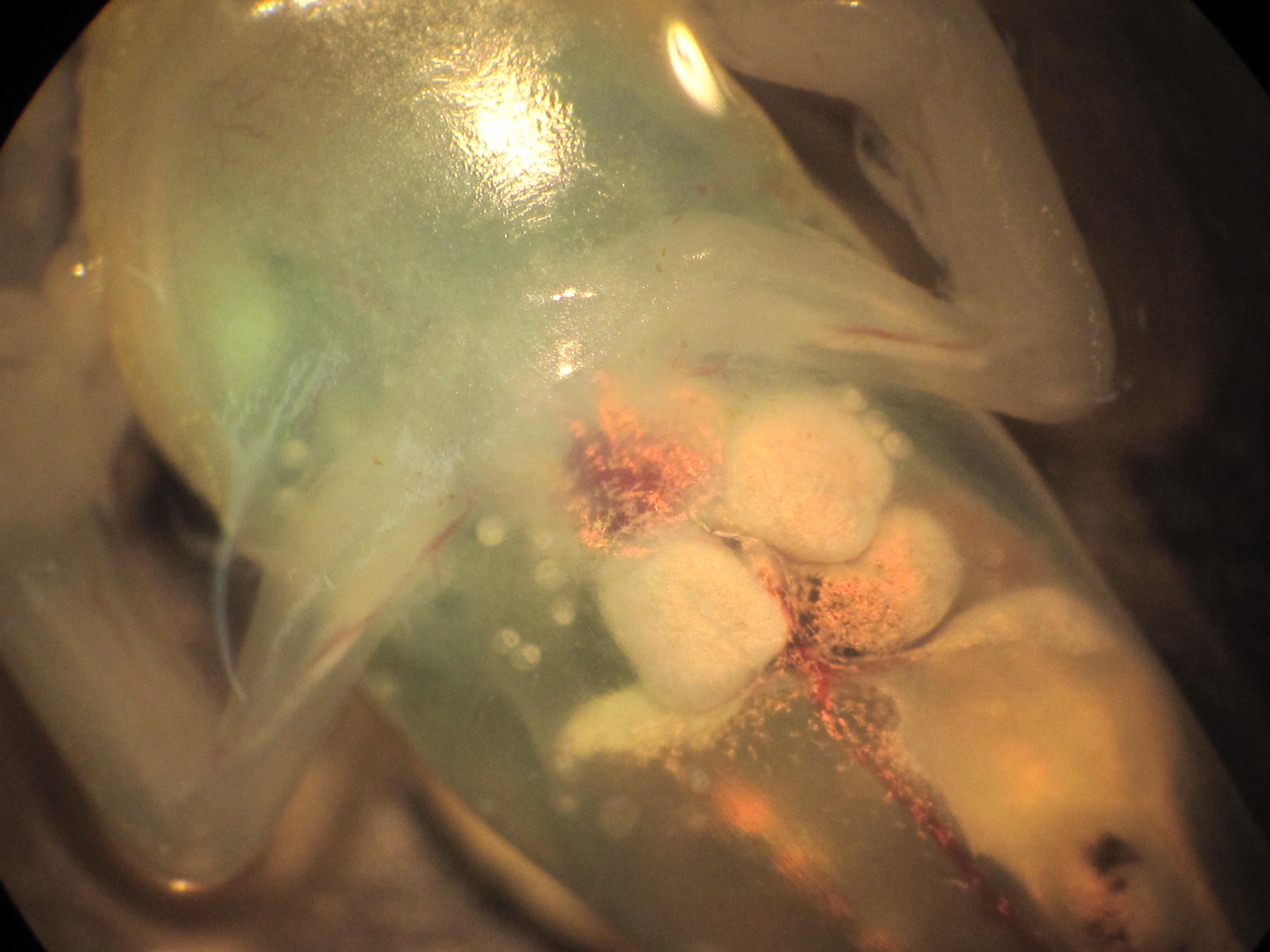 Digenea in tadpole