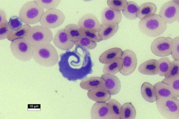 Protozoa